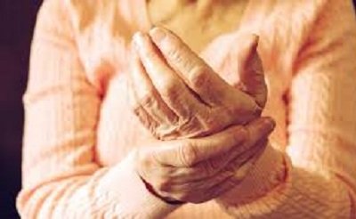 Rheaumotoid Arthritis